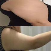 �ֱ���֬�������ڰ����˺�����