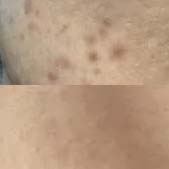 ������ռ� 2���µ�ʱ��Ƥ�����ٴ���