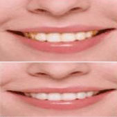 ������׵�Ч���治�� ��ʵ������������