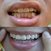 �����ɻƵ��׵�ת�� ����������������