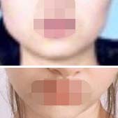 �������������ռ� �沿�Ƕȶ��ܷ���