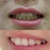 ��ֲ���ռ� ���Ҿ������ݶ�һ������˵��ĺ���Ҫ