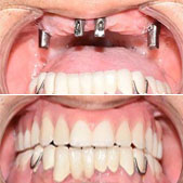 ������ֲ��֮�� �о�����ô��Ǯ����ֵ�õ�