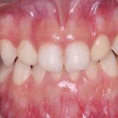 ����1��ĵذ���������ƺ� �������ڻָ�������