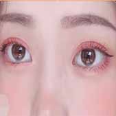 ˫��Ƥ�����ı����۾������� Ҳ���ұ���¸�