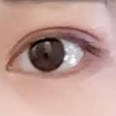 ����˫��Ƥ�Ѿ��������� �۲���������ȫ����ʧ