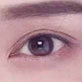 ˫��Ƥ3���º� �����ĺۼ�û��