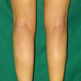 ˫��ƽ��ֱ�߻�ʲôʱ���ܿ���Ч�� 7���˻�������