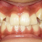 ��Ȼ���ν�������Ǯ�е����� ��65�����Ц��