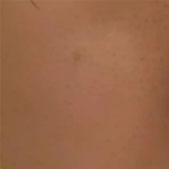 �����۷�����һ�����µ�ʱ��Ƥ���ѻָ�