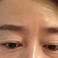 꼪   ˵Ʋ