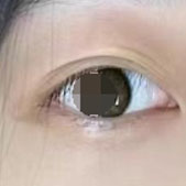 ˫Ƥ ǰͬѧ˫ƤӺÿ