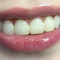 ݱ֮ Цݶ