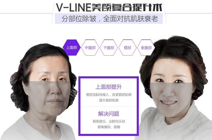 河南整形医院V-LINE美颜复合提升术