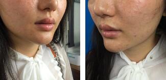 ��ޱ������ᴽ���������괽�Ըв�ʧ�ɰ�