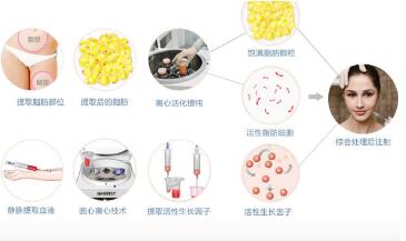 眼泪痕沟的形成原因及解决方法