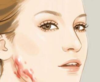 激光去脸上疤痕的价格在多少范围