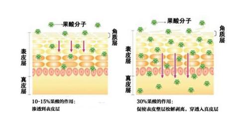 果酸换肤的成分大多是水果吗