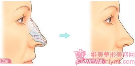 �շ�ǽ�����Ҫ���оֲ�������