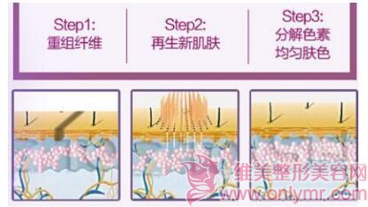 身上的疤痕真讨厌，还是去做疤痕修复吧