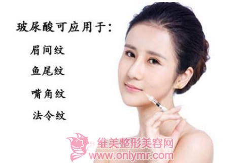 ����������Ч���ܱ��ֶ��