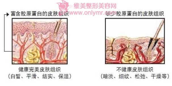 彩光嫩肤能恢复皮肤的细嫩吗