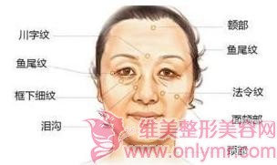 ������ȥ������������Щ����