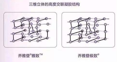 乔雅登玻尿酸除皱的效果如何