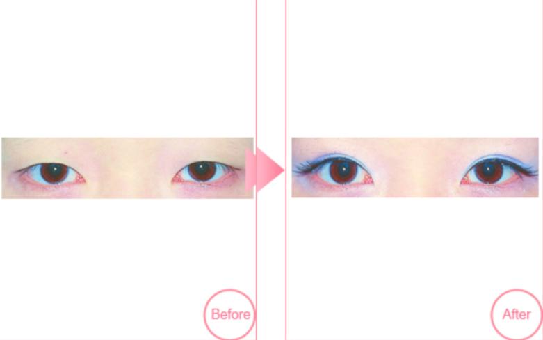 ��˫��Ƥ�������������㶯�����