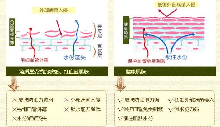 所以,光子嫩肤去红血丝是没有副作用的,相反,它还有嫩肤,美白