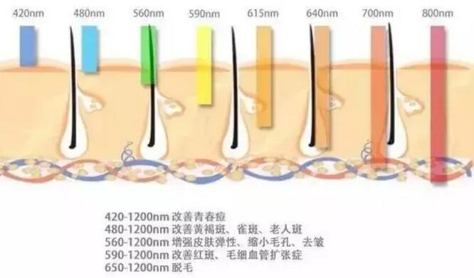 光子嫩肤面部皮肤问题的克星 价格800~1500元