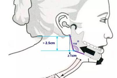 ���������������沿�����ǹؼ�!��������һ���������˺�!��ľ��?