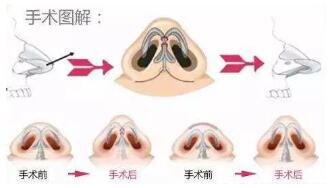 �ǿ���С����������Ȼ��