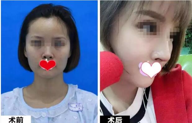 ����ǽ������󷽷�������С����