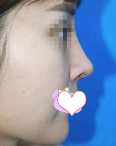 ����ǽ������󷽷�������С����