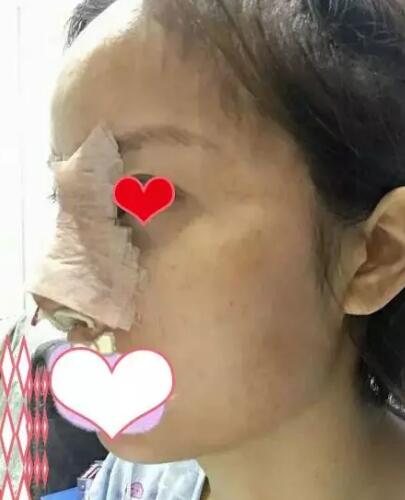 ����ǽ������󷽷�������С����