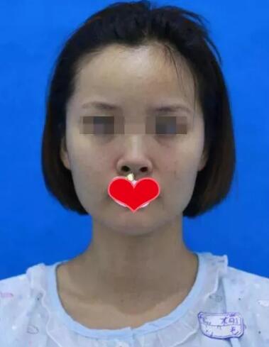 ����ǽ������󷽷�������С����