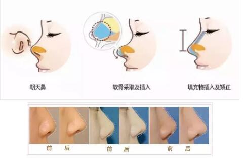 ����ǽ������󷽷�������С����