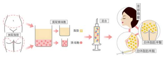 4D全身立体面部轮廓手术术，美肤塑身