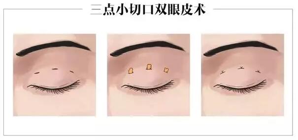 �������˽�˫��Ƥ�Ϳ��۽�