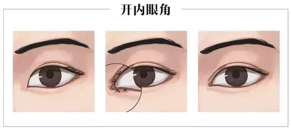 �������˽�˫��Ƥ�Ϳ��۽�