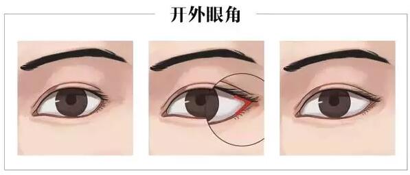 �������˽�˫��Ƥ�Ϳ��۽�