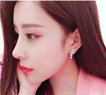 ��������������¡�Ǵ���������ʹ