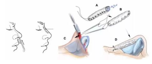 ��������������¡�Ǵ���������ʹ