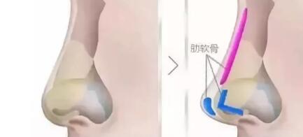 ��������������¡�Ǵ���������ʹ