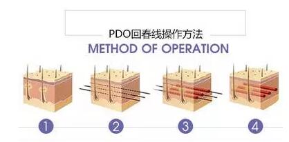 ������������������һ�������