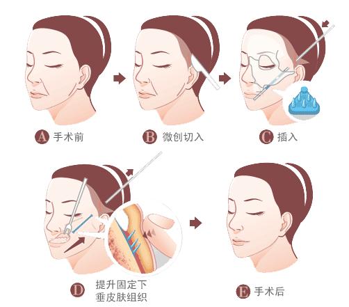 ��ͷ����Ӧ�ø����Լ�ѡ��������������ķ���