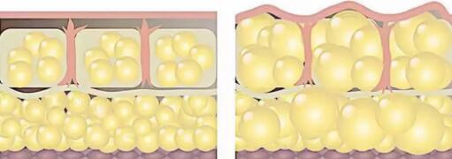 ������ʧ�ܣ�Ϊ�β����Գ�֬