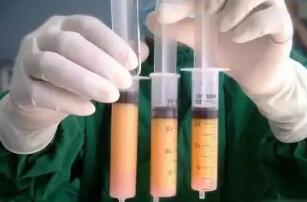 ������ʧ�ܣ�Ϊ�β����Գ�֬