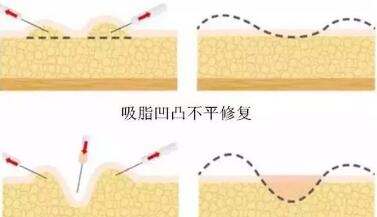 ������ʧ�ܣ�Ϊ�β����Գ�֬